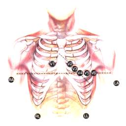 Elektrodeplassering2